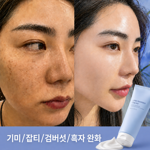 기미원 크림 [기미 잡티 검버섯 색소침착 크림] 기미 잡티 제거 크림1위 트라넥삼산 나이아신아마이드 기미 크림 대용량 기미케어 크림 판테놀 기미크림, 2개