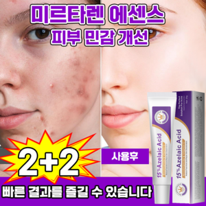 함익병 멜라논 크림 함익병 기미 잡티 제거 멜라논 크림 착색크림 함익병 YONICE 보장증정